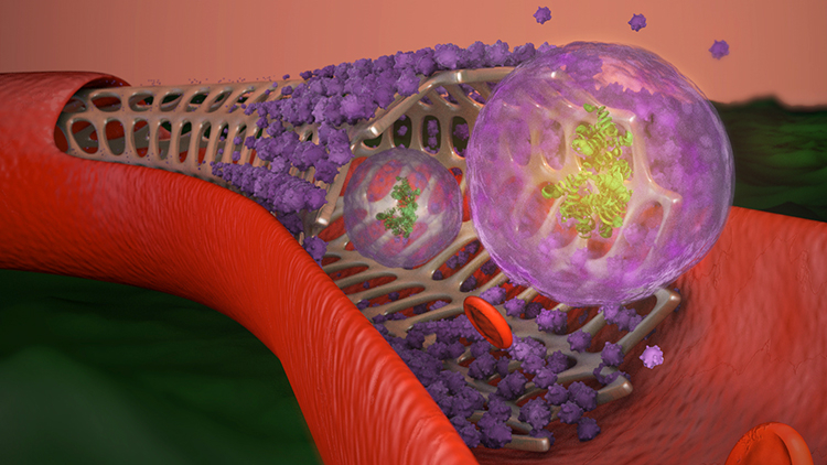 Color illustration of an exosome-coated stent in a cutaway of an artery.