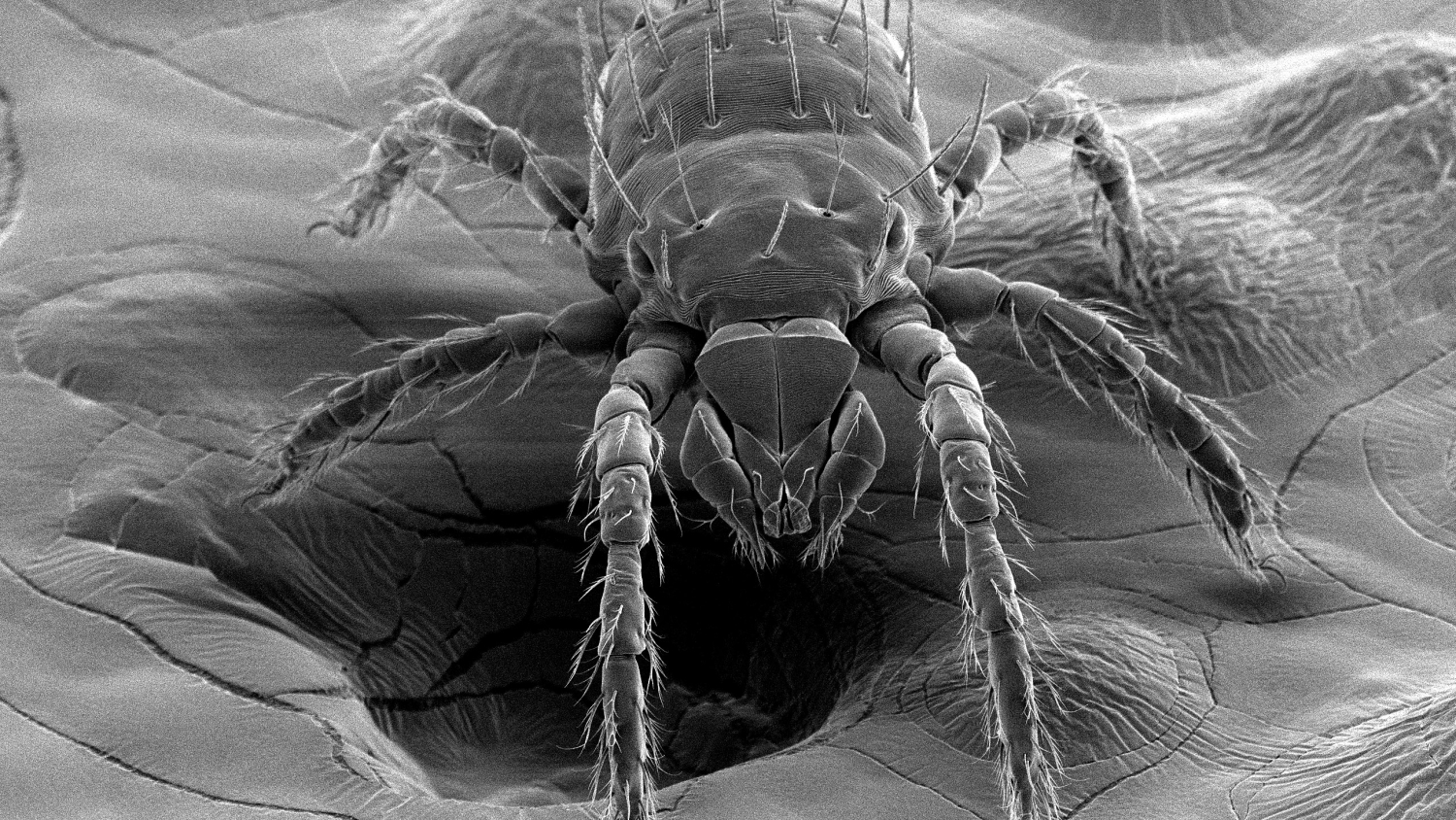 Scanning electron microscopy image of a chigger.