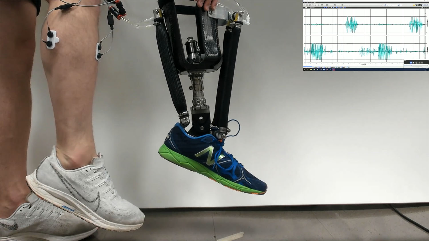 on left part of image, a man's lower leg is shown, with the toes of his feet pointing down. There are sensors attached to his knee and calf. On the right, a robotic prosthetic lower leg is shown flexing in a pose identical to the man's leg. In the upper right hand corner, a graph shows an erratic line that moves up and down.
