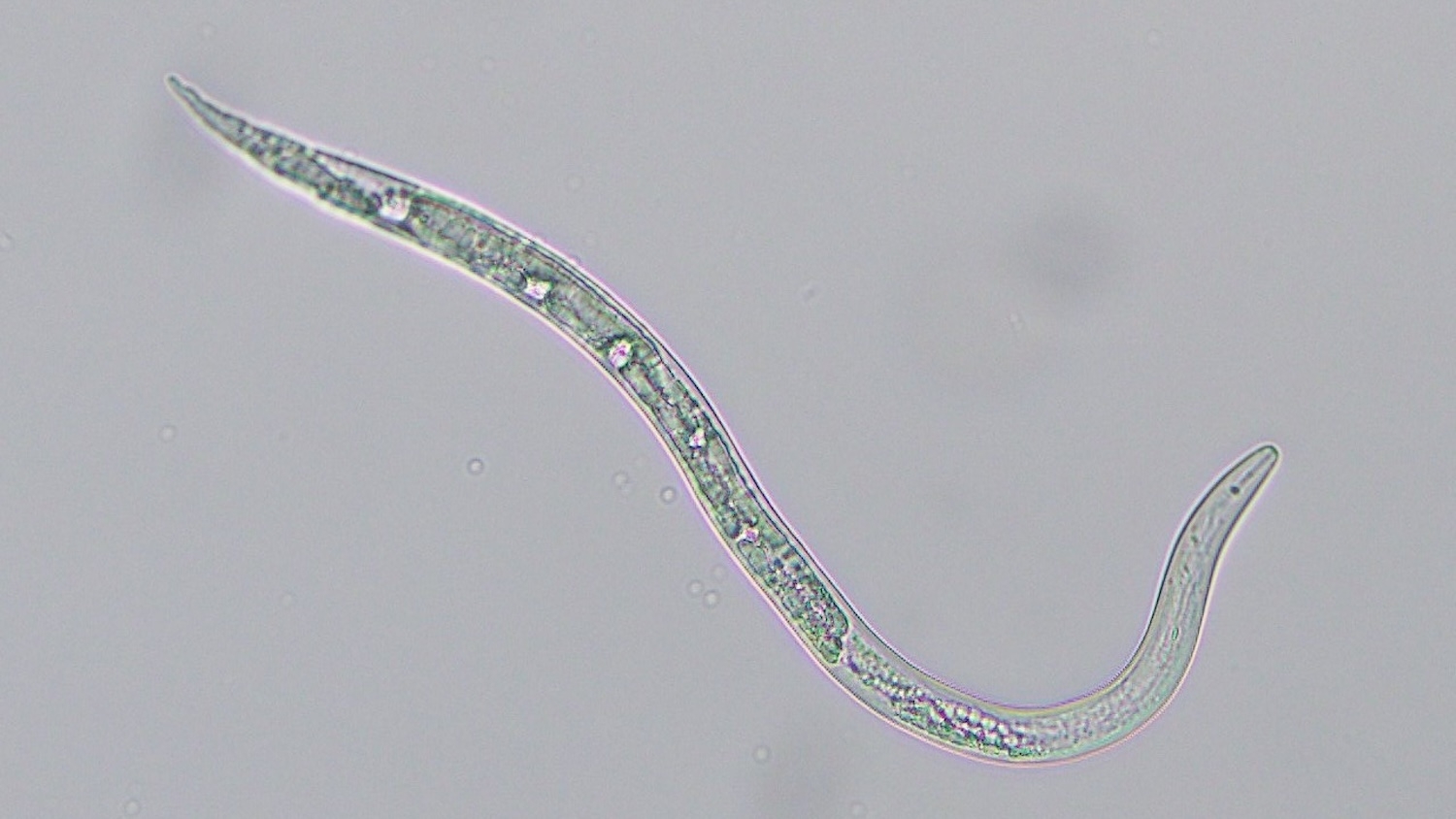 Much-magnified image of the root-know nematode